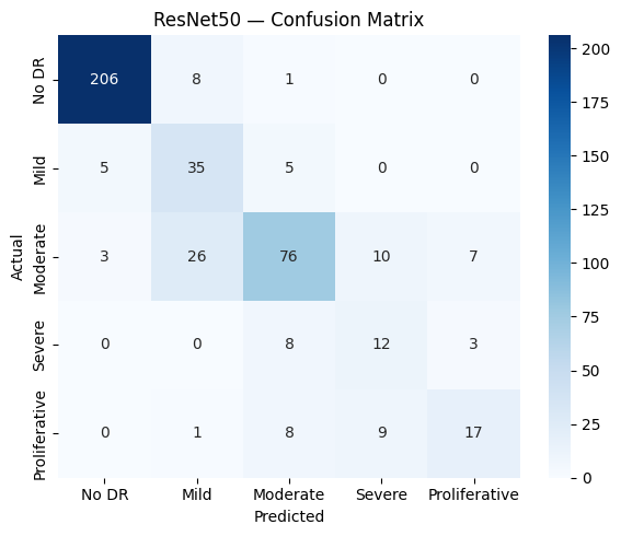 Confusion matrix for the ResNet-50 model across the five diabetic retinopathy grades